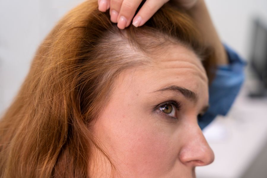 PRP Hair Treatment at MedCare Clinics